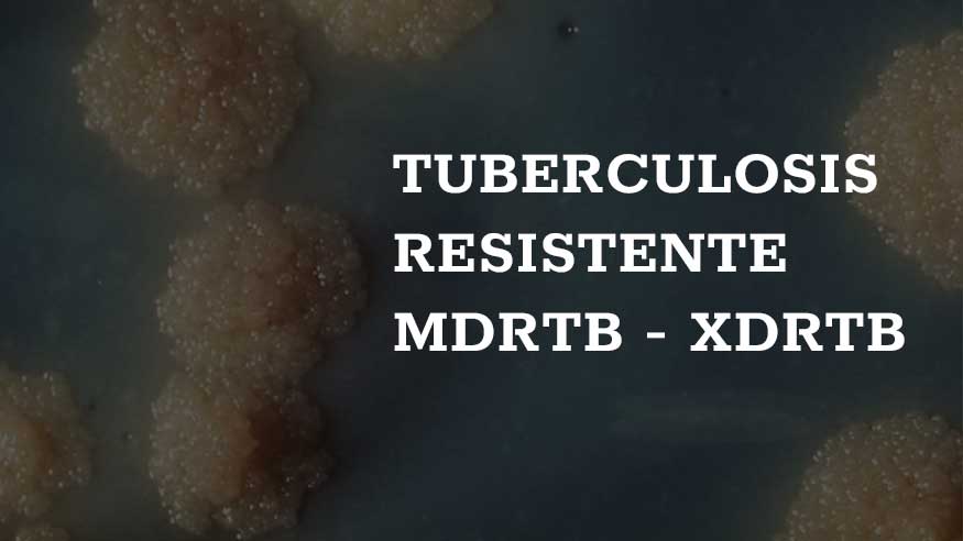 tb-resistente