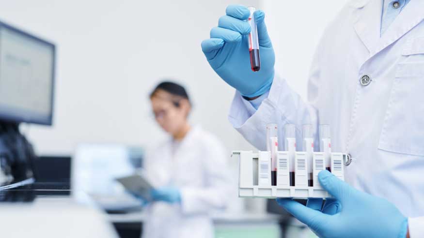 pruebas-de-tb