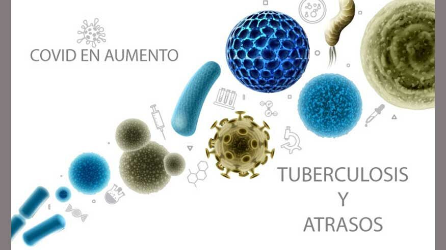 covid-tb-2022